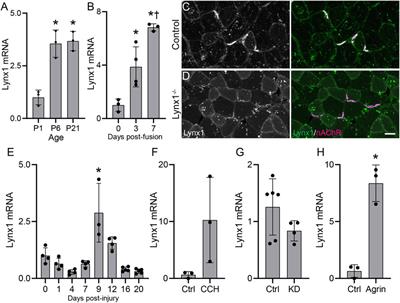 Expression and Roles of Lynx1, a Modulator of Cholinergic Transmission, in Skeletal Muscles and Neuromuscular Junctions in Mice